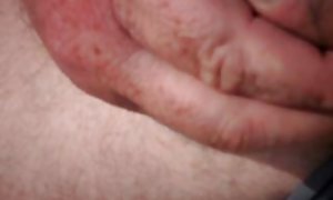 تراشیده چمن در کل صفحه نمایش! در جوراب ساق بلند سفید کشیده و تصادفا سوراخ خود را.